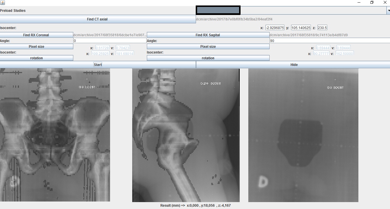 Portal 2D para Radioterapia.